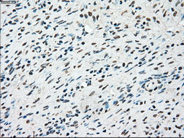 STK3 Antibody - IHC of paraffin-embedded Ovary tissue using anti-STK3 mouse monoclonal antibody. (Dilution 1:50).
