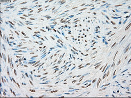 STK3 Antibody - IHC of paraffin-embedded endometrium tissue using anti-STK3 mouse monoclonal antibody. (Dilution 1:50).