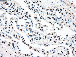 STK3 Antibody - Immunohistochemical staining of paraffin-embedded lung tissue using anti-STK3 mouse monoclonal antibody. (Dilution 1:50).
