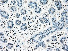 STK3 Antibody - Immunohistochemical staining of paraffin-embedded breast tissue using anti-STK3 mouse monoclonal antibody. (Dilution 1:50).