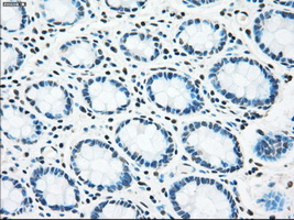 STK3 Antibody - Immunohistochemical staining of paraffin-embedded colon tissue using anti-STK3 mouse monoclonal antibody. (Dilution 1:50).