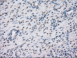 STK3 Antibody - Immunohistochemical staining of paraffin-embedded Ovary tissue using anti-STK3 mouse monoclonal antibody. (Dilution 1:50).