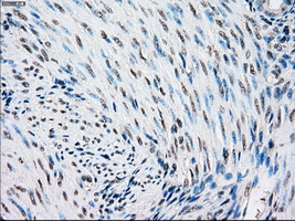 STK3 Antibody - Immunohistochemical staining of paraffin-embedded endometrium tissue using anti-STK3 mouse monoclonal antibody. (Dilution 1:50).