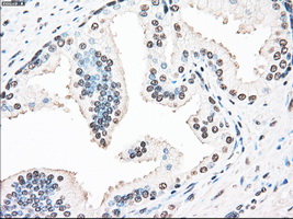 STK3 Antibody - Immunohistochemical staining of paraffin-embedded prostate tissue using anti-STK3 mouse monoclonal antibody. (Dilution 1:50).