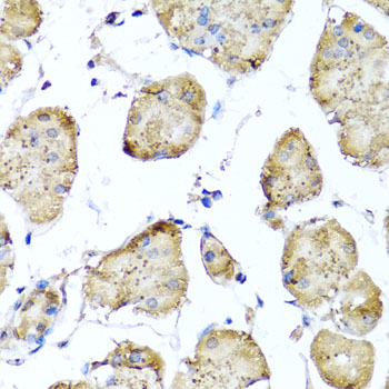 STK3 Antibody - Immunohistochemistry of paraffin-embedded human stomach tissue.