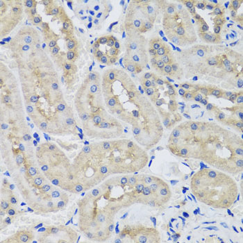 STK3 Antibody - Immunohistochemistry of paraffin-embedded rat kidney tissue.