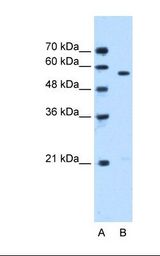 STK3 Antibody - Lane A: Marker. Lane B: Jurkat cell lysate. Antibody concentration: 0.5 ug/ml. Gel concentration: 12%.  This image was taken for the unconjugated form of this product. Other forms have not been tested.