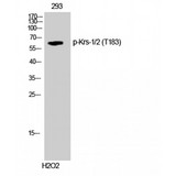 STK3 / STK4 Antibody - Western blot of Phospho-Krs-1/2 (T183) antibody