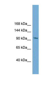 STK31 Antibody - STK31 antibody Western blot of HepG2 cell lysate. This image was taken for the unconjugated form of this product. Other forms have not been tested.