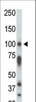 STK31 Antibody - The anti-STK31 antibody is used in Western blot to detect STK31 in rat testis tissue lysate.
