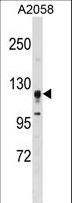 STK31 Antibody - STK31 Antibody (F47) western blot of A2058 cell line lysates (35 ug/lane). The STK31 antibody detected the STK31 protein (arrow).