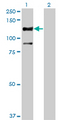 STK31 Antibody - Western blot of STK31 expression in transfected 293T cell line by STK31 monoclonal antibody (M02), clone 1C10.