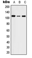 STK31 Antibody - Western blot analysis of STK31 expression in HEK293T (A); SP2/0 (B); PC12 (C) whole cell lysates.