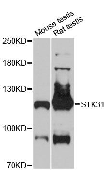 STK31 Antibody - Western blot analysis of extracts of various cell lines, using STK31 antibody at 1:3000 dilution. The secondary antibody used was an HRP Goat Anti-Rabbit IgG (H+L) at 1:10000 dilution. Lysates were loaded 25ug per lane and 3% nonfat dry milk in TBST was used for blocking. An ECL Kit was used for detection and the exposure time was 90s.