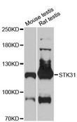STK31 Antibody - Western blot analysis of extracts of various cell lines, using STK31 antibody at 1:3000 dilution. The secondary antibody used was an HRP Goat Anti-Rabbit IgG (H+L) at 1:10000 dilution. Lysates were loaded 25ug per lane and 3% nonfat dry milk in TBST was used for blocking. An ECL Kit was used for detection and the exposure time was 90s.