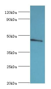 STK32A Antibody - Western blot. All lanes: STK32A antibody at 5 ug/ml+HepG2 whole cell lysate. Secondary antibody: Goat polyclonal to rabbit at 1:10000 dilution. Predicted band size: 46 kDa. Observed band size: 46 kDa.