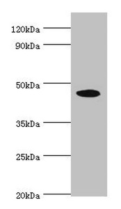 STK32A Antibody - Western blot All lanes: STK32A antibody at 5µg/ml + HepG2 whole cell lysate Secondary Goat polyclonal to rabbit IgG at 1/10000 dilution Predicted band size: 47, 20, 42 kDa Observed band size: 47 kDa