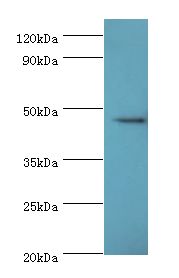 STK32A Antibody - Western blot. All lanes: STK32A antibody at 2 ug/ml+MCF-7 whole cell lysate. Secondary antibody: Goat polyclonal to rabbit at 1:10000 dilution. Predicted band size: 46 kDa. Observed band size: 46 kDa.