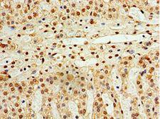 STK32A Antibody - Immunohistochemistry of paraffin-embedded human adrenal gland using antibody at 1:100 dilution.