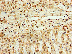 STK32A Antibody - Immunohistochemistry of paraffin-embedded human adrenal gland tissue using STK32A Antibody at dilution of 1:100