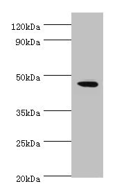 STK32A Antibody - Western blot All lanes: STK32A antibody at 2µg/ml + MCF-7 whole cell lysate Secondary Goat polyclonal to rabbit IgG at 1/10000 dilution Predicted band size: 47, 20, 42 kDa Observed band size: 47 kDa