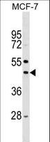 STK32A Antibody - Mouse Stk32a Antibody western blot of MCF-7 cell line lysates (35 ug/lane). The Stk32a antibody detected the Stk32a protein (arrow).