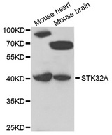 STK32A Antibody - Western blot analysis of extracts of various cell lines.