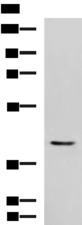 STK32A Antibody - Western blot analysis of Mouse heart tissue lysate  using STK32A Polyclonal Antibody at dilution of 1:1000