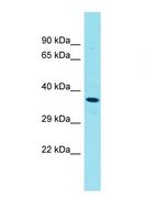 STK32A Antibody - Western blot of Human Thyroid Tumor. STK32A antibody dilution 1.0 ug/ml.  This image was taken for the unconjugated form of this product. Other forms have not been tested.