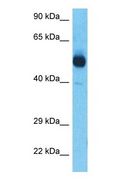 STK32B Antibody - Western blot of ST32B Antibody with human Lung Tumor lysate.  This image was taken for the unconjugated form of this product. Other forms have not been tested.