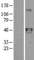 STK32B Protein - Western validation with an anti-DDK antibody * L: Control HEK293 lysate R: Over-expression lysate