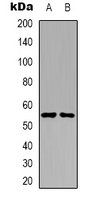 STK32C / PKE Antibody - Western blot analysis of PKE expression in A431 (A); Raji (B) whole cell lysates.