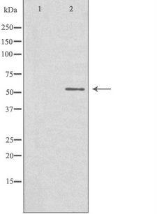 STK32C / PKE Antibody - Western blot analysis of extracts of Jurkat cells using STK32C antibody. The lane on the left is treated with the antigen-specific peptide.