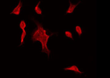 STK32C / PKE Antibody - Staining HeLa cells by IF/ICC. The samples were fixed with PFA and permeabilized in 0.1% Triton X-100, then blocked in 10% serum for 45 min at 25°C. The primary antibody was diluted at 1:200 and incubated with the sample for 1 hour at 37°C. An Alexa Fluor 594 conjugated goat anti-rabbit IgG (H+L) Ab, diluted at 1/600, was used as the secondary antibody.