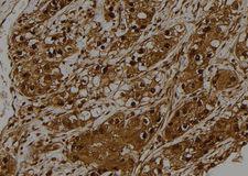 STK32C / PKE Antibody - 1:100 staining human kidney tissue by IHC-P. The sample was formaldehyde fixed and a heat mediated antigen retrieval step in citrate buffer was performed. The sample was then blocked and incubated with the antibody for 1.5 hours at 22°C. An HRP conjugated goat anti-rabbit antibody was used as the secondary.