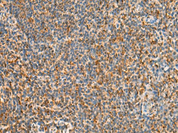 STK32C / PKE Antibody - Immunohistochemistry of paraffin-embedded Human tonsil tissue  using STK32C Polyclonal Antibody at dilution of 1:40(×200)