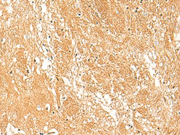 STK32C / PKE Antibody - Immunohistochemistry of paraffin-embedded Human brain tissue  using STK32C Polyclonal Antibody at dilution of 1:30(×200)