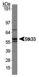 STK33 Antibody - STK33 Antibody - WB detection of Stk33 in HEK293 cell lysate.  This image was taken for the unconjugated form of this product. Other forms have not been tested.
