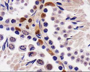 STK33 Antibody - STK33 Antibody - IHC of STK33 in mouse testis.  This image was taken for the unconjugated form of this product. Other forms have not been tested.