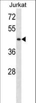 STK33 Antibody - STK33 Antibody western blot of Jurkat cell line lysates (35 ug/lane). The STK33 antibody detected the STK33 protein (arrow).