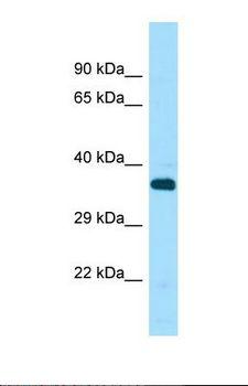 STK33 Antibody - Western blot of Human THP-1. STK33 antibody dilution 1.0 ug/ml.  This image was taken for the unconjugated form of this product. Other forms have not been tested.