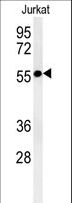 STK33 Antibody - STK33-T481 western blot of NCI-H460 cell line lysates (35 ug/lane). The STK33 antibody detected the STK33 protein (arrow).