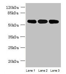 STK33 Antibody - Western blot All lanes: STK33 antibody at 4µg/ml Lane 1: Mouse kidney tissue Lane 2: Hela whole cell lysate Lane 3: Jurkat whole cell lysate Secondary Goat polyclonal to rabbit IgG at 1/10000 dilution Predicted band size: 58, 51 kDa Observed band size: 58 kDa