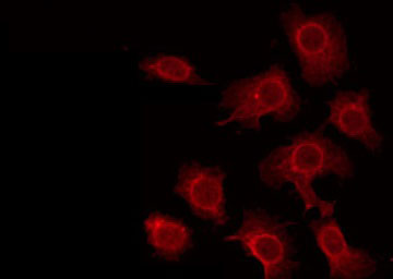 STK33 Antibody - Staining HeLa cells by IF/ICC. The samples were fixed with PFA and permeabilized in 0.1% Triton X-100, then blocked in 10% serum for 45 min at 25°C. The primary antibody was diluted at 1:200 and incubated with the sample for 1 hour at 37°C. An Alexa Fluor 594 conjugated goat anti-rabbit IgG (H+L) Ab, diluted at 1/600, was used as the secondary antibody.
