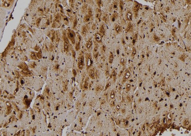 STK33 Antibody - 1:100 staining human heart tissue by IHC-P. The sample was formaldehyde fixed and a heat mediated antigen retrieval step in citrate buffer was performed. The sample was then blocked and incubated with the antibody for 1.5 hours at 22°C. An HRP conjugated goat anti-rabbit antibody was used as the secondary.