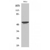 STK33 Antibody - Western blot of STK33 antibody
