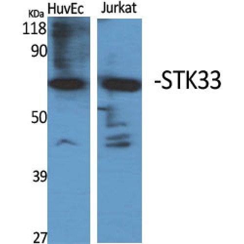 STK33 Antibody - Western blot of STK33 antibody