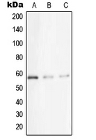 STK33 Antibody - Western blot analysis of STK33 expression in A431 (A); Jurkat (B); HeLa (C) whole cell lysates.