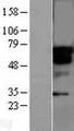 STK33 Protein - Western validation with an anti-DDK antibody * L: Control HEK293 lysate R: Over-expression lysate