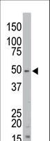STK35 Antibody - The anti-STK35 antibody is used in Western blot to detect STK35 in mouse kidney tissue lysate.